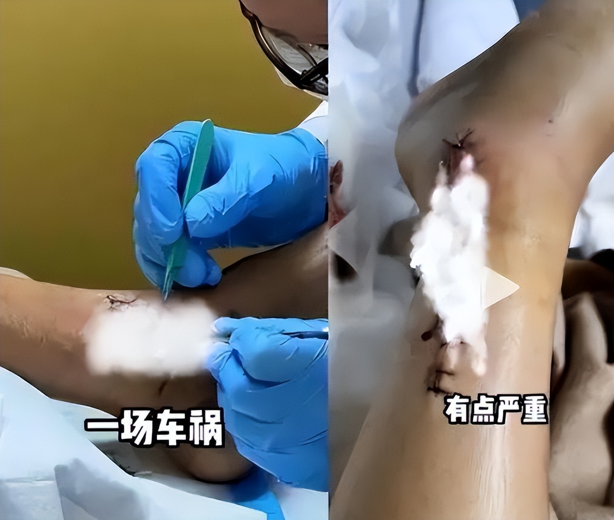 演员陈学冬：11部作品被下架，两年4次手术，今35岁生活无法自理__演员陈学冬：11部作品被下架，两年4次手术，今35岁生活无法自理