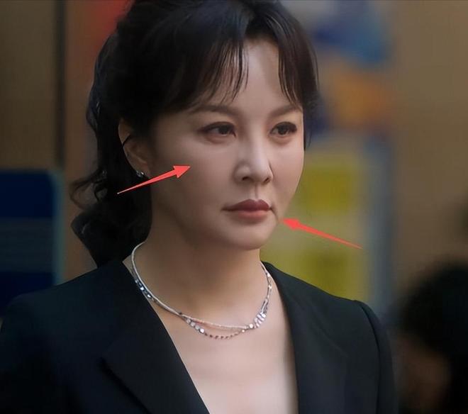 光涨年龄不涨演技！馒头脸，香肠唇，这些整容脸又来祸害央视剧了__光涨年龄不涨演技！馒头脸，香肠唇，这些整容脸又来祸害央视剧了