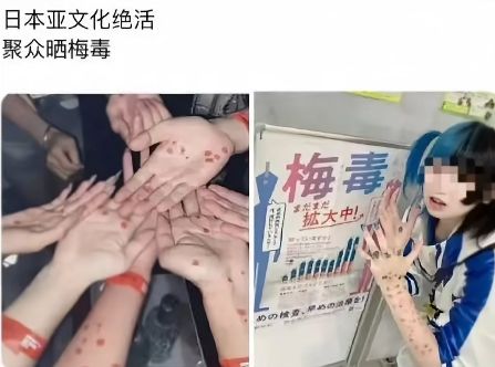 日本梅毒泛滥、“神待少女” 丛生：百毒遍地，遥遥领先_日本梅毒泛滥、“神待少女” 丛生：百毒遍地，遥遥领先_