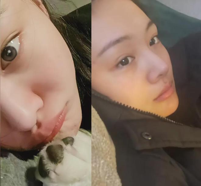 _郑爽的脸撑不了多久了_郑爽的脸还好吗