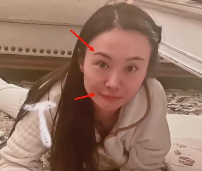 郑爽的脸还好吗__郑爽的脸撑不了多久了