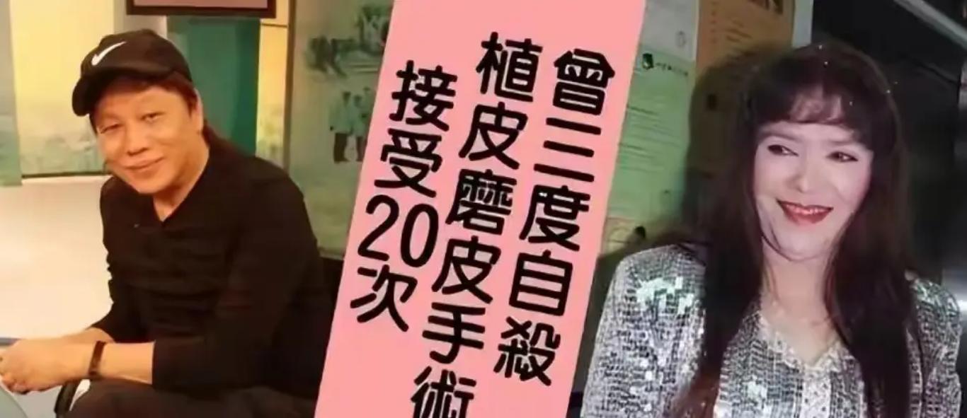 梁小龙之后再无陈真！因爱国被封杀20年，发妻被泼硫酸毁容_梁小龙之后再无陈真！因爱国被封杀20年，发妻被泼硫酸毁容_