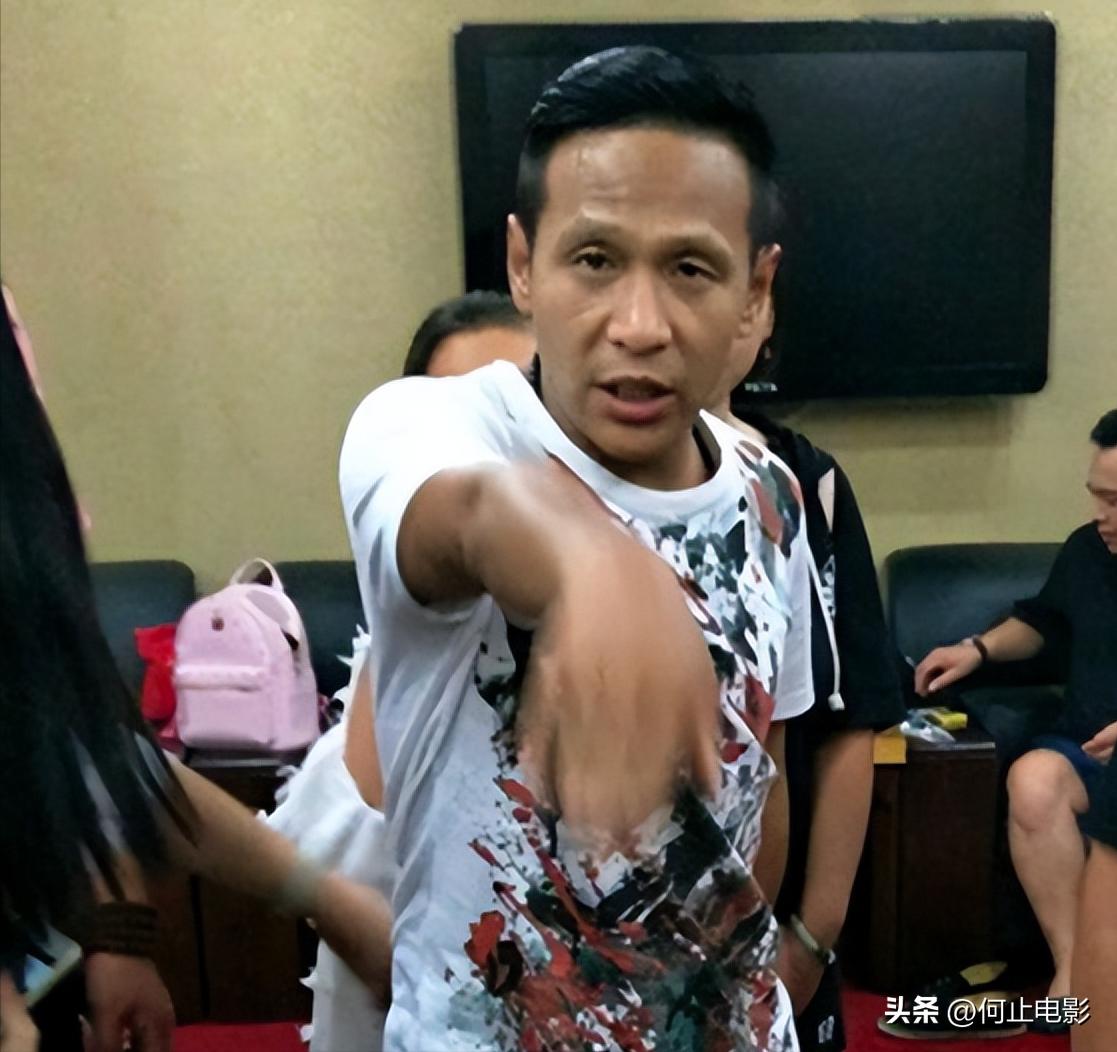 宋小宝自爆脸上动了刀！抛妻娶粉、玩弄感情的他，终于付出了代价_宋小宝自爆脸上动了刀！抛妻娶粉、玩弄感情的他，终于付出了代价_