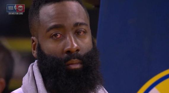 _哈登g1受伤_哈登90度骨折