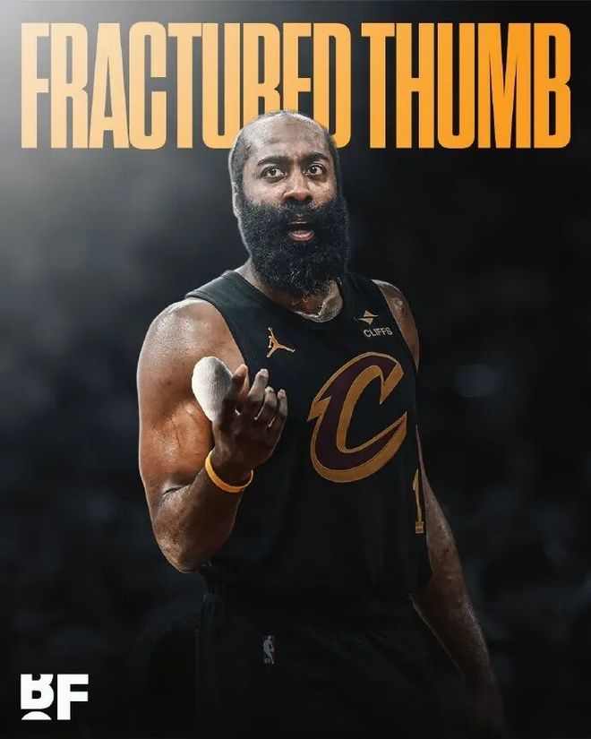 哈登90度骨折__哈登g1受伤