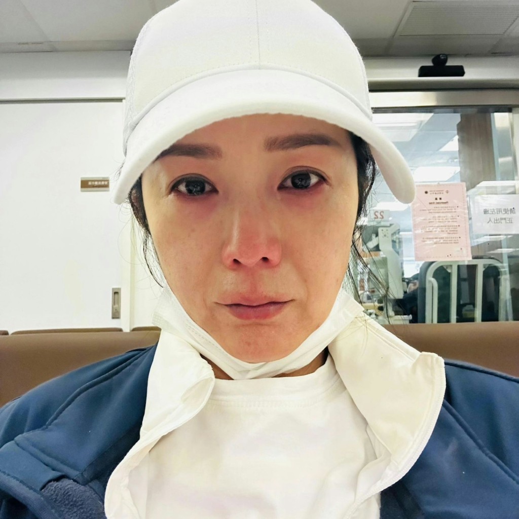 每天被痛醒!前港姐季军抗癌最惨状态曝光,仍咬牙不放弃__每天被痛醒!前港姐季军抗癌最惨状态曝光,仍咬牙不放弃