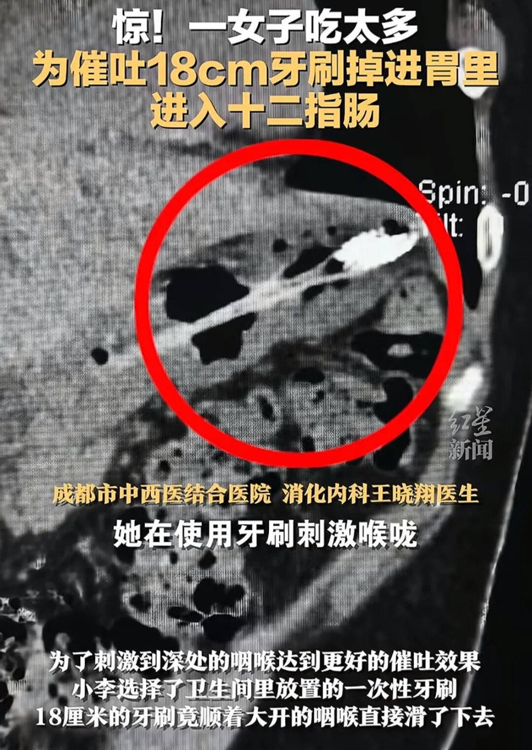 _被全网封禁的“吃室友剩饭”网红：畸形现象，正在恶心中国年轻人_被全网封禁的“吃室友剩饭”网红：畸形现象，正在恶心中国年轻人