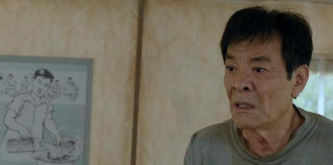 脸撞肿怎么办_脸撞肿了会毁容吗_