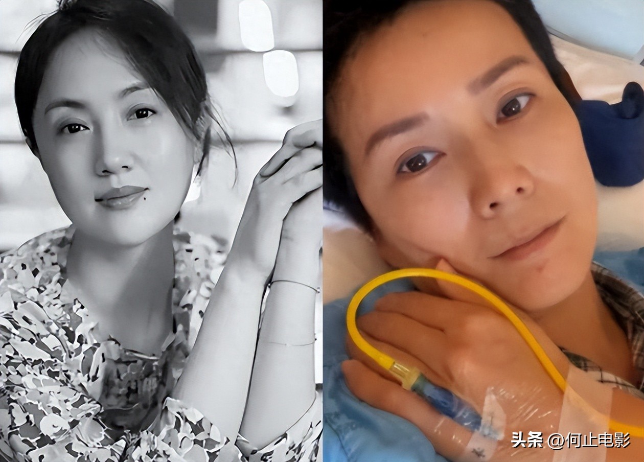 又一位女星走上朱媛媛的老路，自曝癌症晚期，身体流脓标靶药失效__又一位女星走上朱媛媛的老路，自曝癌症晚期，身体流脓标靶药失效